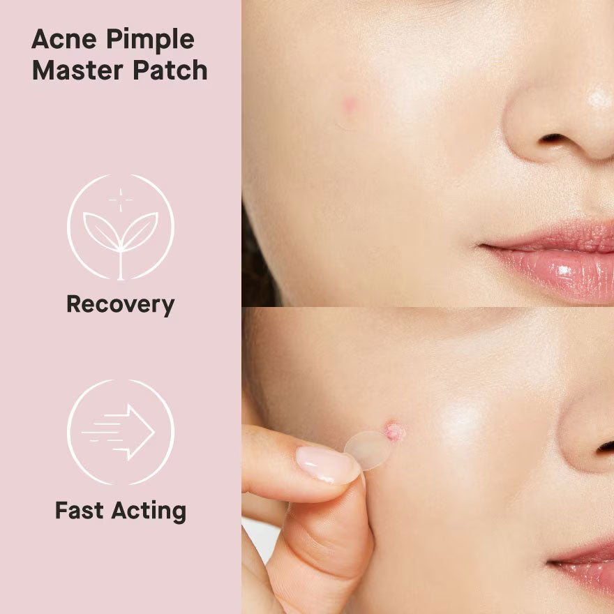 COSRX Acne Pimple Master Patch – Pickel-Patches für schnelle Heilung – Unsichtbare Hydrokolloid-Pflaster gegen Pickel & Unreinheiten